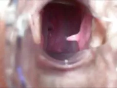 Menutup dari vagina